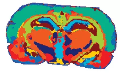 Segmentation analysis of brain tissue